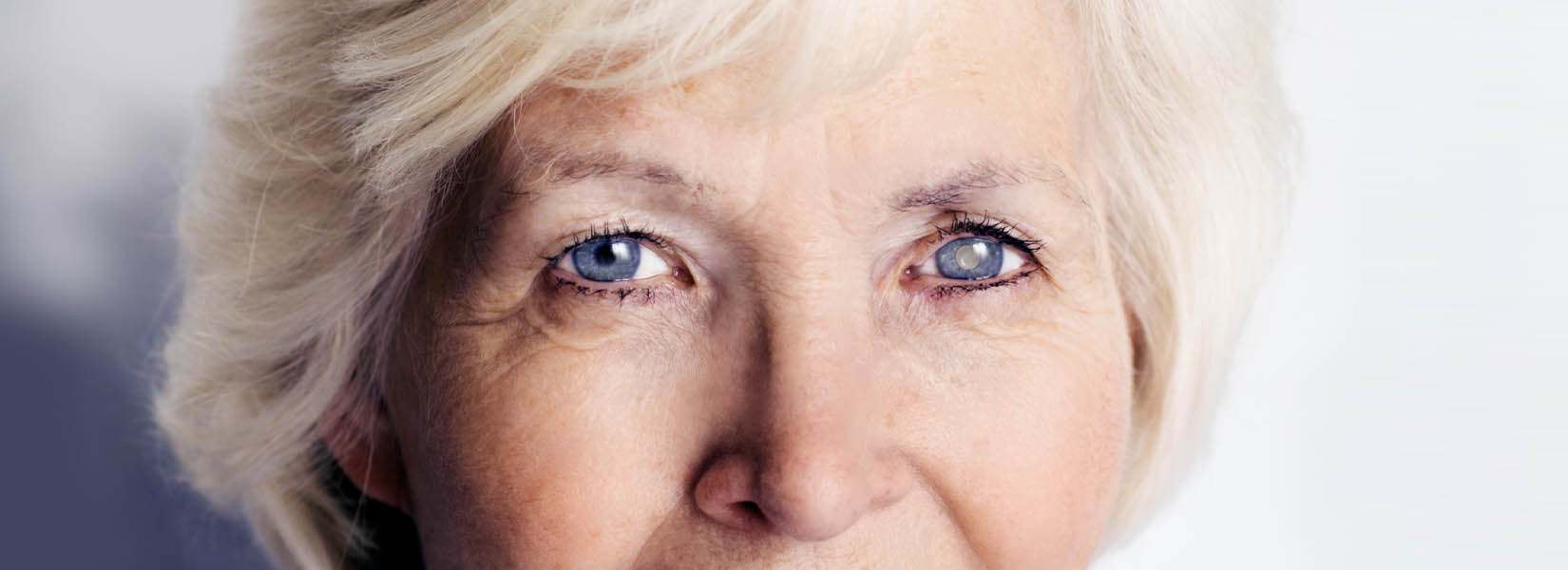 Cataract Surgery in Southwest Houston